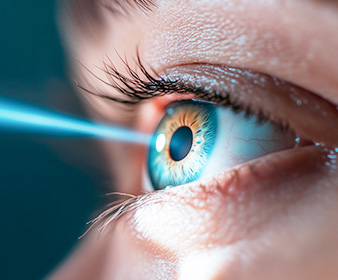 fundus camera(안저촬영)